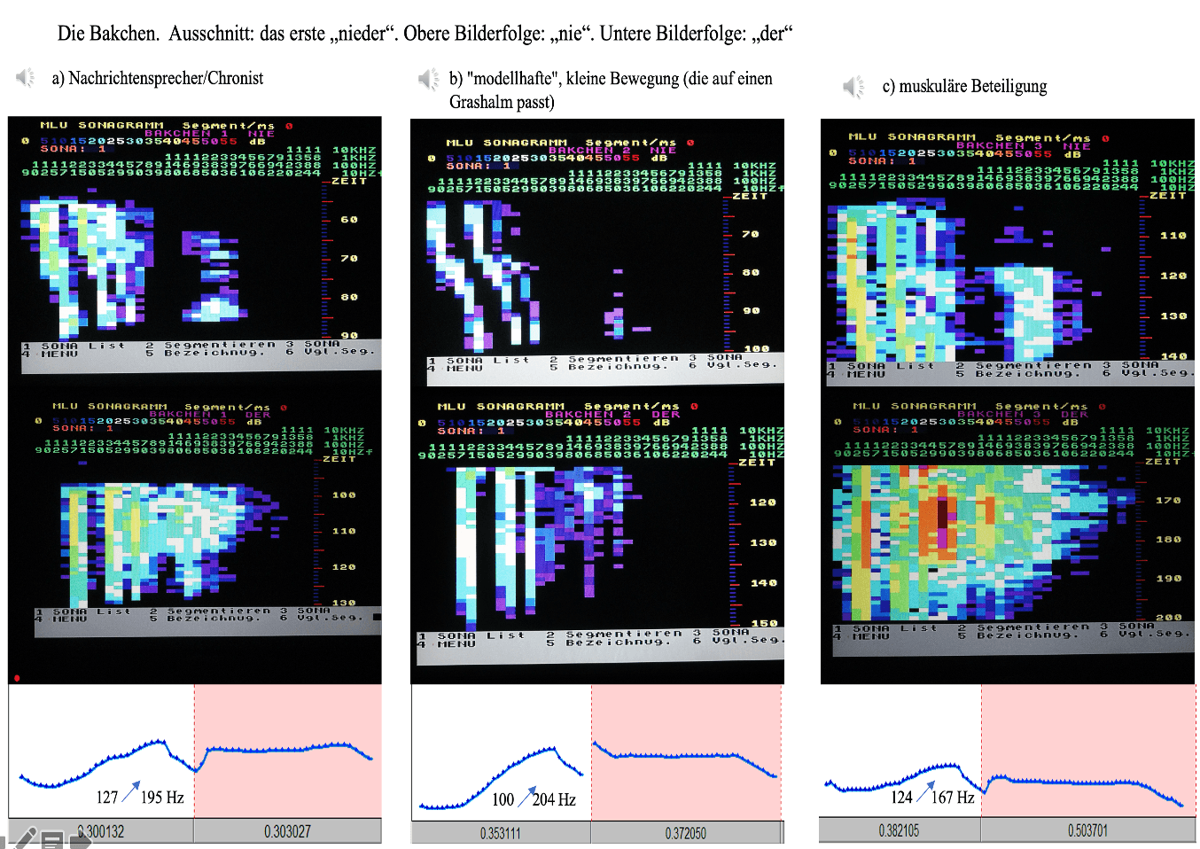 Die beiden Silben des Wortes wurden getrennt analysiert. In der oberen Reihe erscheint in drei Varianten die Silbe [ni:], in der unteren Reihe dreimal die Silbe [dɐ].